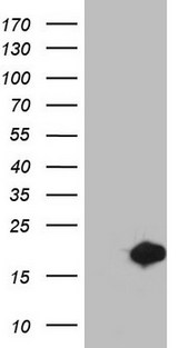 MSRB3 Antibody - HEK293T cells were transfected with the pCMV6-ENTRY control (Left lane) or pCMV6-ENTRY MSRB3 (Right lane) cDNA for 48 hrs and lysed. Equivalent amounts of cell lysates (5 ug per lane) were separated by SDS-PAGE and immunoblotted with anti-MSRB3.