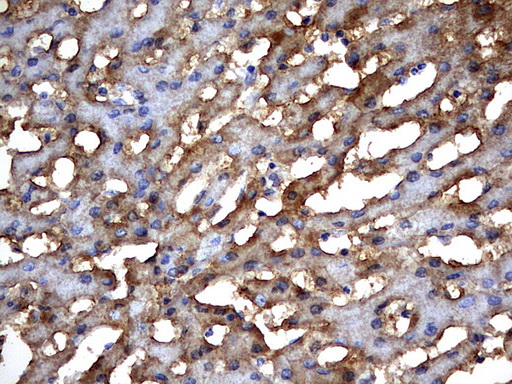 MSRB3 Antibody - IHC of paraffin-embedded Human liver tissue using anti-MSRB3 mouse monoclonal antibody. (Heat-induced epitope retrieval by 10mM citric buffer, pH6.0, 120°C for 3min).