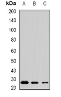 MSRB3 Antibody - Western blot analysis of MSRB3 expression in mouse testis (A); mouse brain (B); rat lung (C) whole cell lysates.