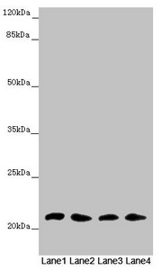 MSRB3 Antibody - Western blot All Lanes: MSRB3 antibody at 4.61 ug/ml Lane 1: Mouse large intestine tissue Lane 2: Mouse lung tissue Lane 3: Mouse gonadal tissue Lane 4: Mouse heart tissue Secondary Goat polyclonal to rabbit IgG at 1/10000 dilution Predicted band size: 21 kDa Observed band size: 21 kDa
