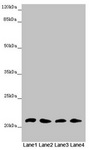 MSRB3 Antibody - Western blot All Lanes: MSRB3 antibody at 4.61 ug/ml Lane 1: Mouse large intestine tissue Lane 2: Mouse lung tissue Lane 3: Mouse gonadal tissue Lane 4: Mouse heart tissue Secondary Goat polyclonal to rabbit IgG at 1/10000 dilution Predicted band size: 21 kDa Observed band size: 21 kDa