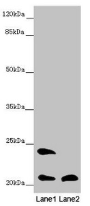 MSRB3 Antibody - Western blot All Lanes: MSRB3 antibody at 8.08 ug/ml Lane 1: Mouse lung tissue Lane 2: Mouse heart tissue Secondary Goat polyclonal to rabbit IgG at 1/10000 dilution Predicted band size: 21 kDa Observed band size: 21,24 kDa