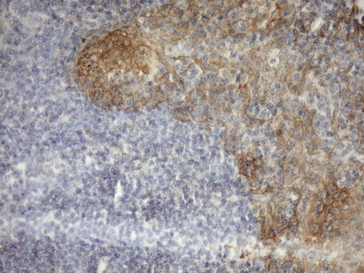 MST1 Antibody - Immunohistochemical staining of paraffin-embedded Human tonsil within the normal limits using anti-MST1 mouse monoclonal antibody. (Heat-induced epitope retrieval by Tris-EDTA, pH8.0)(1:150)