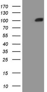 MST1 Antibody - HEK293T cells were transfected with the pCMV6-ENTRY control (Left lane) or pCMV6-ENTRY MST1 (Right lane) cDNA for 48 hrs and lysed. Equivalent amounts of cell lysates (5 ug per lane) were separated by SDS-PAGE and immunoblotted with anti-MST1 (1:2000).