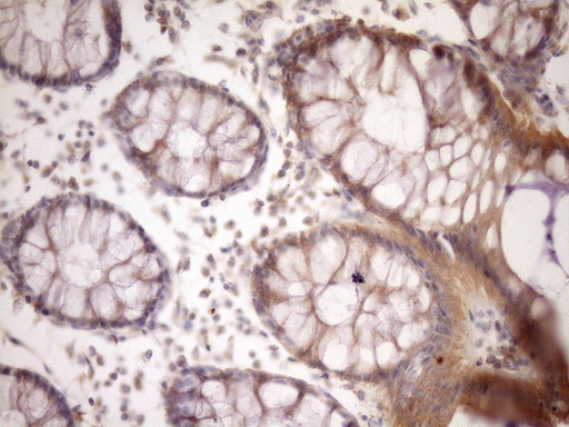 MST1 Antibody - IHC of paraffin-embedded Human colon tissue using anti-MST1 mouse monoclonal antibody. (Heat-induced epitope retrieval by Tris-EDTA, pH8.0)(1:150).