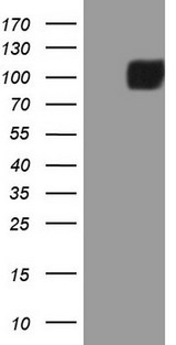 MST1 Antibody - HEK293T cells were transfected with the pCMV6-ENTRY control. (Left lane) or pCMV6-ENTRY MST1. (Right lane) cDNA for 48 hrs and lysed. Equivalent amounts of cell lysates. (5 ug per lane) were separated by SDS-PAGE and immunoblotted with anti-MST1. (1:2000)
