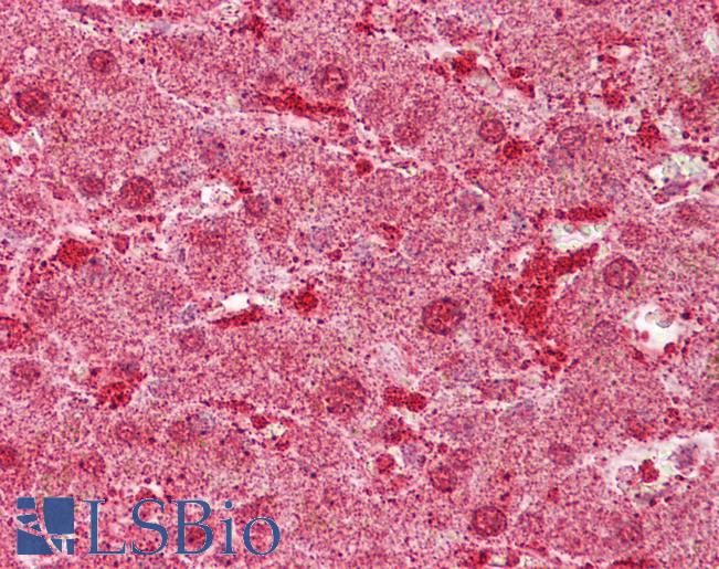MST1 Antibody - Anti-MST1 antibody IHC of human liver. Immunohistochemistry of formalin-fixed, paraffin-embedded tissue after heat-induced antigen retrieval. Antibody concentration 5 ug/ml.  This image was taken for the unconjugated form of this product. Other forms have not been tested.