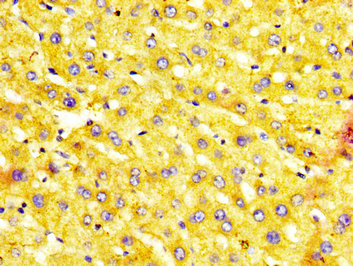 MST1 Antibody - Immunohistochemistry image at a dilution of 1:400 and staining in paraffin-embedded human liver tissue performed on a Leica BondTM system. After dewaxing and hydration, antigen retrieval was mediated by high pressure in a citrate buffer (pH 6.0) . Section was blocked with 10% normal goat serum 30min at RT. Then primary antibody (1% BSA) was incubated at 4 °C overnight. The primary is detected by a biotinylated secondary antibody and visualized using an HRP conjugated SP system.
