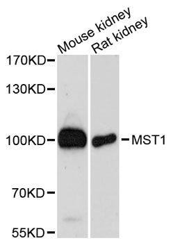 MST1 Antibody - Western blot analysis of extracts of various cell lines, using MST1 antibody at 1:3000 dilution. The secondary antibody used was an HRP Goat Anti-Rabbit IgG (H+L) at 1:10000 dilution. Lysates were loaded 25ug per lane and 3% nonfat dry milk in TBST was used for blocking. An ECL Kit was used for detection and the exposure time was 90s.
