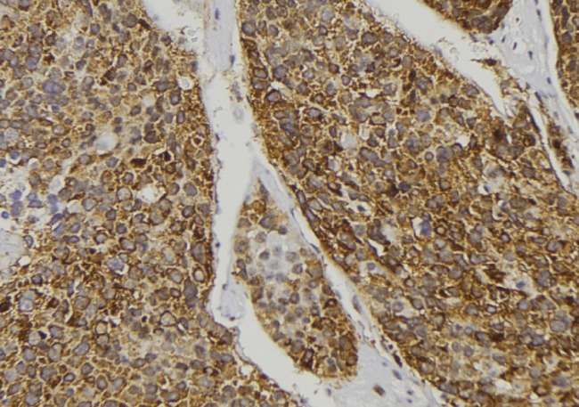 MST1 Antibody - 1:100 staining human pancreas tissue by IHC-P. The sample was formaldehyde fixed and a heat mediated antigen retrieval step in citrate buffer was performed. The sample was then blocked and incubated with the antibody for 1.5 hours at 22°C. An HRP conjugated goat anti-rabbit antibody was used as the secondary.