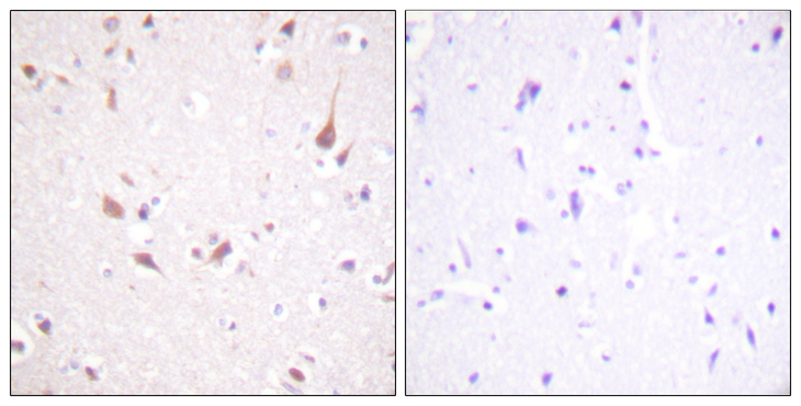 MST1 + MST2 Antibody - Immunohistochemistry analysis of paraffin-embedded human brain tissue, using Mst1/2 Antibody. The picture on the right is blocked with the synthesized peptide.
