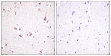 MST1 + MST2 Antibody - Immunohistochemistry analysis of paraffin-embedded human brain tissue, using Mst1/2 Antibody. The picture on the right is blocked with the synthesized peptide.