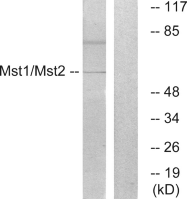 MST1 + MST2 Antibody - Western blot analysis of lysates from HeLa cells, treated with UV 15', using Mst1/2 Antibody. The lane on the right is blocked with the synthesized peptide.