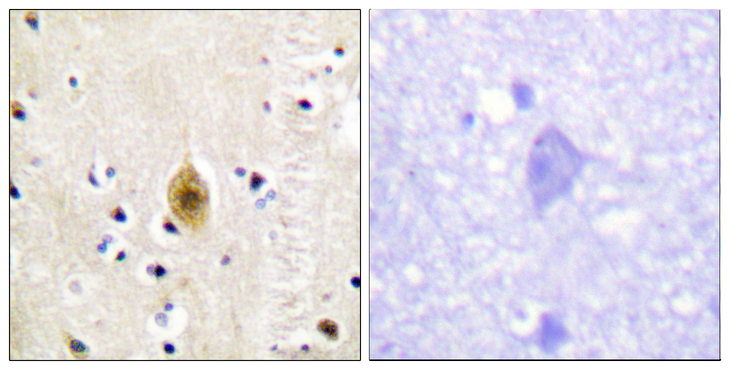 MST1 + MST2 Antibody - Immunohistochemistry analysis of paraffin-embedded human brain, using Mst1/2 (Phospho-Thr183) Antibody. The picture on the right is blocked with the phospho peptide.