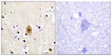 MST1 + MST2 Antibody - Immunohistochemistry analysis of paraffin-embedded human brain, using Mst1/2 (Phospho-Thr183) Antibody. The picture on the right is blocked with the phospho peptide.