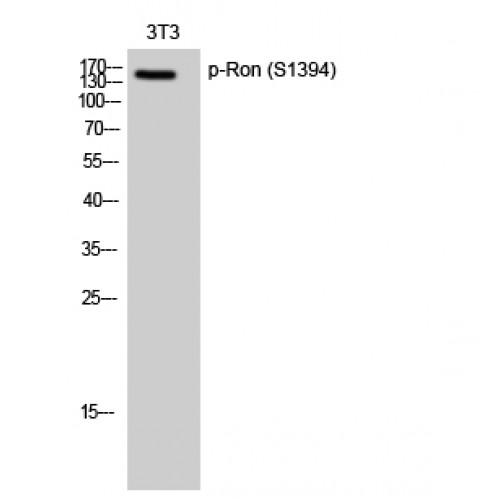 MST1R / RON Antibody - Western blot of Phospho-Ron (S1394) antibody
