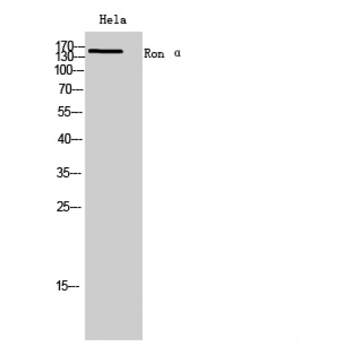 MST1R / RON Antibody - Western blot of Ron alpha antibody