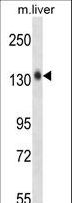 MST1R / RON Antibody - Mouse Mst1r Antibody western blot of mouse liver tissue lysates (35 ug/lane). The Mst1r antibody detected the Mst1r protein (arrow).