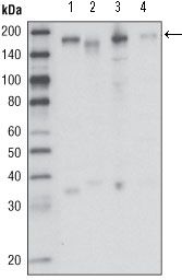 MST1R / RON Antibody - RON Antibody in Western Blot (WB)