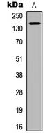 MST1R / RON Antibody - Western blot analysis of CD136 (pS1394) expression in A431 (A) whole cell lysates.
