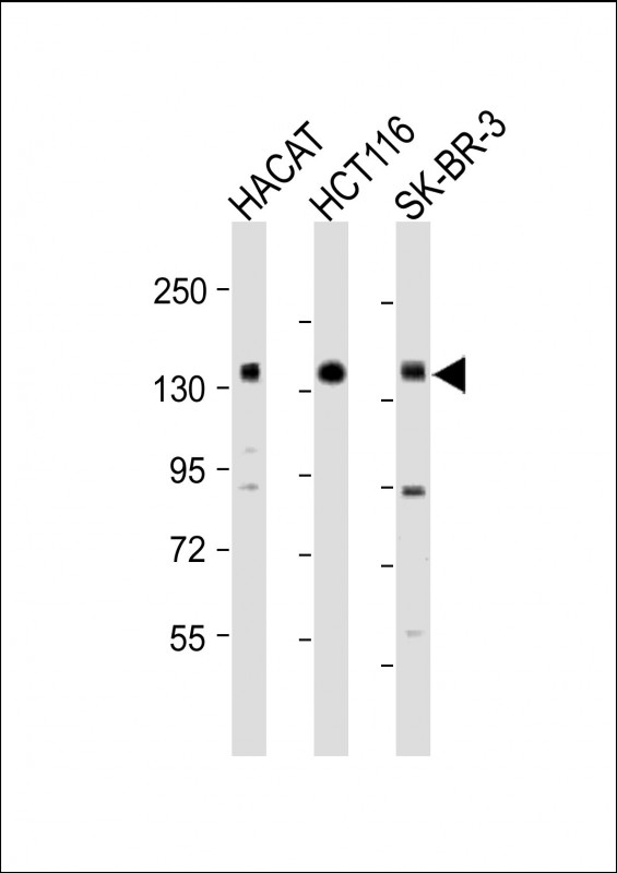 MST1R / RON Antibody - All lanes: Anti-MST1R Antibody (Center) at 1:1000-1:2000 dilution Lane 1: HACAT whole cell lysate Lane 2: HCT116 whole cell lysate Lane 3: SK-BR-3 whole cell lysate Lysates/proteins at 20 µg per lane. Secondary Goat Anti-Rabbit IgG, (H+L), Peroxidase conjugated at 1/10000 dilution. Predicted band size: 152 kDa Blocking/Dilution buffer: 5% NFDM/TBST.