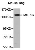 MST1R / RON Antibody - Western blot analysis of extracts of mouse lung, using MST1R antibody. The secondary antibody used was an HRP Goat Anti-Rabbit IgG (H+L) at 1:10000 dilution. Lysates were loaded 25ug per lane and 3% nonfat dry milk in TBST was used for blocking.