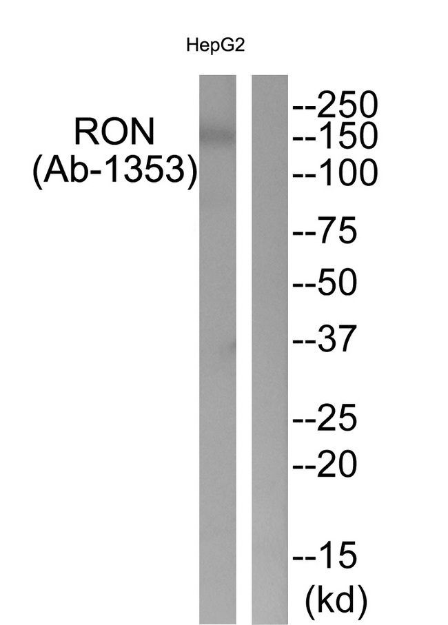 MST1R / RON Antibody - Western blot of extracts from HepG2 cells, using RON (Ab-1353) antibody.