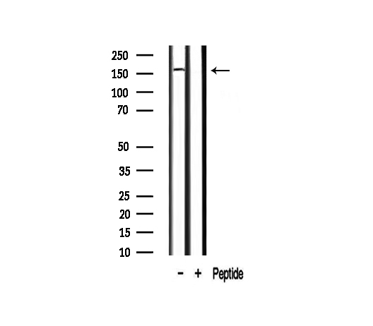 MST1R / RON Antibody - Western blot analysis on mouse lung lysate using RON antibody. The lane on the right is treated with the antigen-specific peptide.