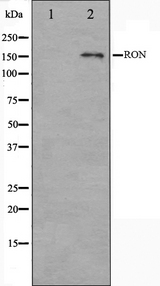 MST1R / RON Antibody - Western blot analysis on HeLa cell lysates using RON antibody. The lane on the left is treated with the antigen-specific peptide.