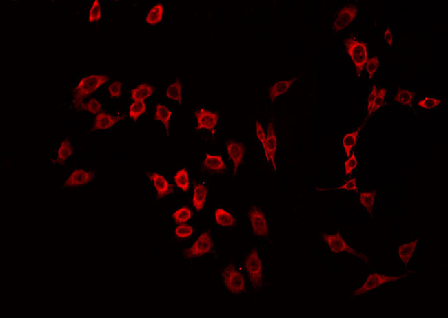 MST1R / RON Antibody - Staining HeLa cells by IF/ICC. The samples were fixed with PFA and permeabilized in 0.1% Triton X-100, then blocked in 10% serum for 45 min at 25°C. The primary antibody was diluted at 1:200 and incubated with the sample for 1 hour at 37°C. An Alexa Fluor 594 conjugated goat anti-rabbit IgG (H+L) Ab, diluted at 1/600, was used as the secondary antibody.
