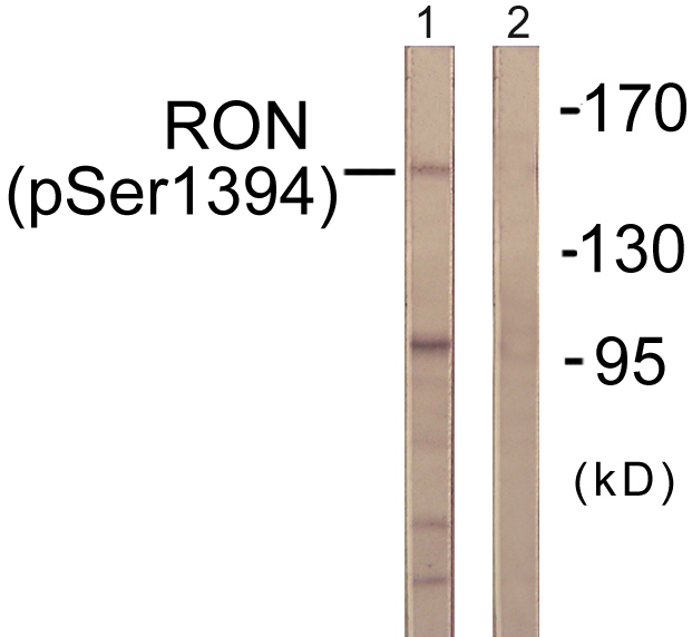 MST1R / RON Antibody - Western blot analysis of lysates from HeLa cells treated with TNF-a 20ng/ml 2', using CD136/RON (Phospho-Ser1394) Antibody. The lane on the right is blocked with the phospho peptide.