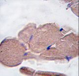 MSTN / GDF8 / Myostatin Antibody - Formalin-fixed and paraffin-embedded human skeletal muscle tissue reacted with GDF8 antibody (N-term ), which was peroxidase-conjugated to the secondary antibody, followed by DAB staining. This data demonstrates the use of this antibody for immunohistochemistry; clinical relevance has not been evaluated.