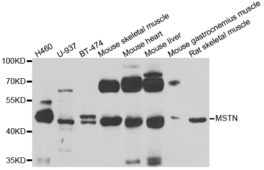 MSTN / GDF8 / Myostatin Antibody - Western blot analysis of extracts of various cell lines.