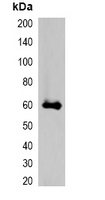 mStrawberry Tag Antibody - Western blot analysis of over-expressed mStrawberry-tagged protein in 293T cell lysate.