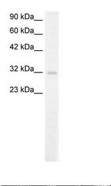 MSX1 Antibody - Fetal Kidney Lysate.  This image was taken for the unconjugated form of this product. Other forms have not been tested.