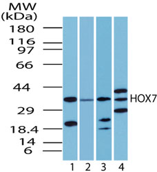 MSX1 Antibody - Western blot of human HOX7 in human liver lysate in the 1) absence, 2) presence of immunizing peptide, 3) mouse and 4) rat liver using antibody at 2 ug/ml.