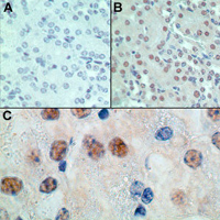 MSX1 Antibody - IHC of HOX7 expression in formalin-fixed, paraffin embedded normal mouse liver tissue. A: Staining with rabbit IgG (isotype control) at 2.5 ug/ml. B: Staining with rabbit anti-HOX7 (antibody) at 2.5 ug/ml. C: Higher magnification