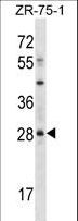 MSX2 / MSH Antibody - MSX2 Antibody western blot of ZR-75-1 cell line lysates (35 ug/lane). The MSX2 antibody detected the MSX2 protein (arrow).