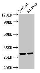MSX2 / MSH Antibody - Positive Western Blot detected in Jurkat whole cell lysate, Rat kidney tissue. All lanes: MSX2 antibody at 2 µg/ml Secondary Goat polyclonal to rabbit IgG at 1/50000 dilution. Predicted band size: 29 KDa. Observed band size: 29 KDa