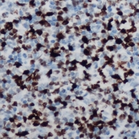 MSX2 / MSH Antibody - Immunohistochemical analysis of MSX2 staining in human lymph node formalin fixed paraffin embedded tissue section. The section was pre-treated using heat mediated antigen retrieval with sodium citrate buffer (pH 6.0). The section was then incubated with the antibody at room temperature and detected using an HRP conjugated compact polymer system. DAB was used as the chromogen. The section was then counterstained with haematoxylin and mounted with DPX.