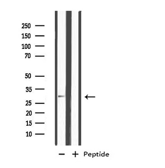 MSX2 / MSH Antibody - Western blot analysis of extracts of COLO205 cells using MSX2 antibody.