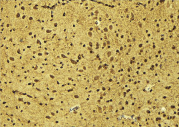 MSX2 / MSH Antibody - 1:100 staining mouse brain tissue by IHC-P. The sample was formaldehyde fixed and a heat mediated antigen retrieval step in citrate buffer was performed. The sample was then blocked and incubated with the antibody for 1.5 hours at 22°C. An HRP conjugated goat anti-rabbit antibody was used as the secondary.