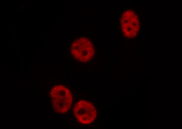 MSX2 / MSH Antibody - Staining COLO205 cells by IF/ICC. The samples were fixed with PFA and permeabilized in 0.1% Triton X-100, then blocked in 10% serum for 45 min at 25°C. The primary antibody was diluted at 1:200 and incubated with the sample for 1 hour at 37°C. An Alexa Fluor 594 conjugated goat anti-rabbit IgG (H+L) antibody, diluted at 1/600, was used as secondary antibody.
