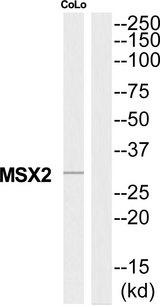 MSX2 / MSH Antibody - Western blot analysis of extracts from COLO205 cells, using MSX2 antibody.