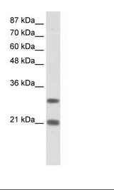 MSX2 / MSH Antibody - Jurkat Cell Lysate.  This image was taken for the unconjugated form of this product. Other forms have not been tested.