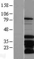 MSX2 / MSH Protein - Western validation with an anti-DDK antibody * L: Control HEK293 lysate R: Over-expression lysate