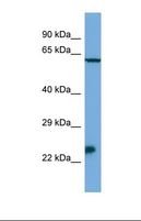 Msx3 Antibody - Western blot of Mouse SP2/0. Msx3 antibody dilution 1.0 ug/ml.  This image was taken for the unconjugated form of this product. Other forms have not been tested.