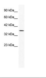 MSY2 / YBX2 Antibody - HepG2 Cell Lysate.  This image was taken for the unconjugated form of this product. Other forms have not been tested.