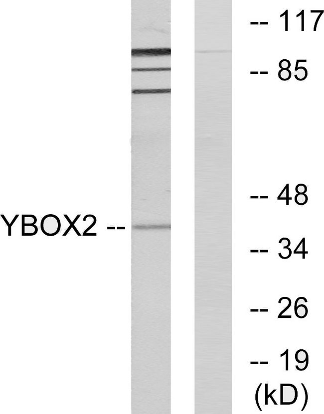 MSY2 / YBX2 Antibody - Western blot analysis of lysates from COLO205 cells, using YBOX2 Antibody. The lane on the right is blocked with the synthesized peptide.