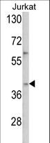 MSY2 / YBX2 Antibody - Western blot of YBX2 Antibody in Jurkat cell line lysates (35 ug/lane). YBX2 (arrow) was detected using the purified antibody.